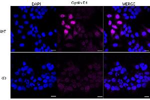anti-Cyclin D1 (CCND1) antibody