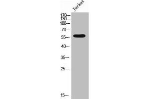 Western Blot analysis of JK cells using Phospho-4. (EPB41 Antikörper  (pTyr660))