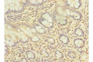 Immunohistochemistry of paraffin-embedded human small intestine tissue using ABIN7144056 at dilution of 1:100 (ZFAND2A Antikörper  (AA 1-145))