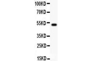 Anti- IL18 Picoband antibody, Western blotting All lanes: Anti IL18  at 0. (IL-18 Antikörper  (AA 36-192))