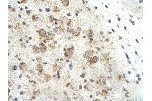 Immunohistochemistry (IHC) image for anti-Mortality Factor 4 Like 2 (MORF4L2) (N-Term) antibody (ABIN2778086)