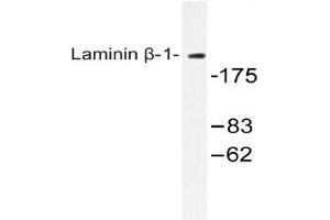 Western blot (WB) analysis of Laminin beta-1 antibody in extracts from HepG2 cells.