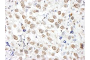 Immunohistochemistry (IHC) image for anti-Topoisomerase I Binding, arginine/serine-Rich, E3 Ubiquitin Protein Ligase (TOPORS) (AA 995-1045) antibody (ABIN7453819)