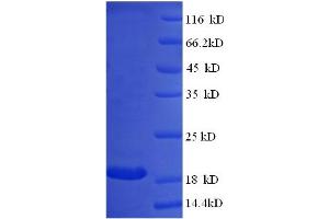 SDS-PAGE (SDS) image for Interferon, alpha 14 (IFNa14) (AA 24-189) protein (GST tag) (ABIN5709713)