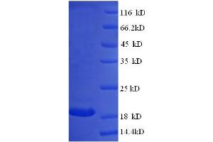 SDS-PAGE (SDS) image for Interferon, alpha 14 (IFNa14) (AA 24-189) protein (GST tag) (ABIN5709713) (IFNa14 Protein (AA 24-189) (GST tag))