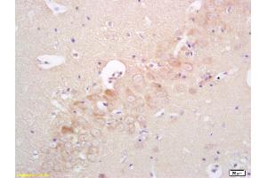 Formalin-fixed and paraffin embedded rat brain labeled with Rabbit Anti phospho-IRAK4(Thr345)Polyclonal Antibody, Unconjugated (ABIN753538) at 1:200 followed by conjugation to the secondary antibody and DAB staining (IRAK4 Antikörper  (pThr345))