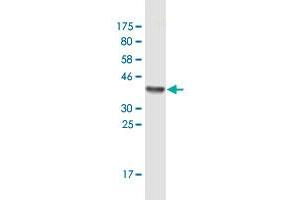 Western Blot detection against Immunogen (36. (Exportin 2 Antikörper  (AA 872-971))