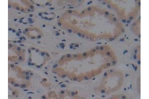 Immunohistochemistry (IHC) image for anti-Mitogen-Activated Protein Kinase Kinase Kinase 1 (MAP3K1) (AA 1307-1509) antibody (ABIN7442936)