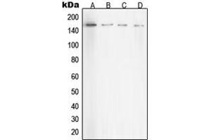 Western blot analysis of ROCK1 expression in HeLa (A), NIH3T3 (B), C6 (C), COS7 (D) whole cell lysates. (ROCK1 Antikörper  (Center))