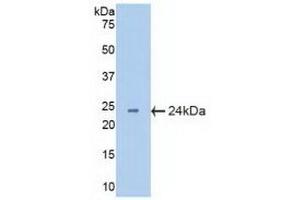 Detection of Recombinant CRYbB2, Mouse using Polyclonal Antibody to Crystallin Beta B2 (CRYbB2)