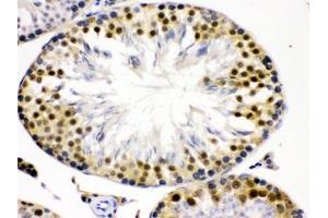 IHC testing of FFPE rat testis with Cdk2 antibody.
