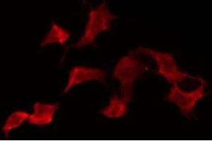 ABIN6275880 staining NIH-3T3 by IF/ICC. (KLRK1 Antikörper  (Internal Region))