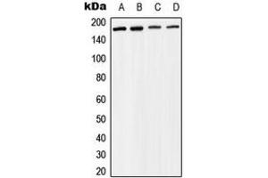 Western blot analysis of BAF170 expression in Raji (A), MCF7 (B), mouse liver (C), rat liver (D) whole cell lysates. (SMARCC2 Antikörper  (Center))