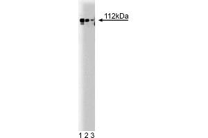Western Blotting (WB) image for anti-Adaptor-Related Protein Complex 2, alpha 1 Subunit (AP2A1) (AA 38-215) antibody (ABIN968009) (alpha Adaptin Antikörper  (AA 38-215))