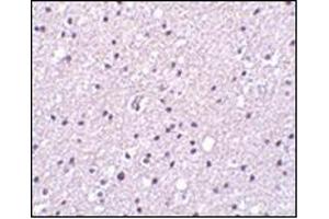 Immunohistochemistry of Neurotrypsin in human brain tissue with this product at 2. (Neurotrypsin Antikörper  (N-Term))