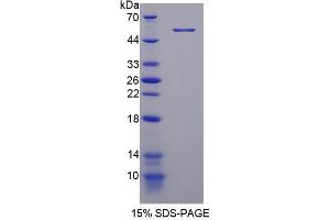 Image no. 1 for phosphodiesterase 4D, cAMP-Specific (PDE4D) (AA 581-809) protein (His tag,GST tag) (ABIN4990451)