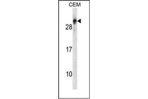 Western blot analysis of RGS5 Antibody (N-term) in CEM cell line lysates (35ug/lane). (RGS5 Antikörper  (N-Term))