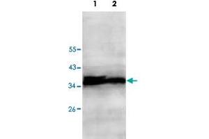 Western blot analysis of HepG2 (Lane 1) and Jurkat (Lane 2) cell lysate with ECH1 polyclonal antibody  at 1 : 500 dilution.