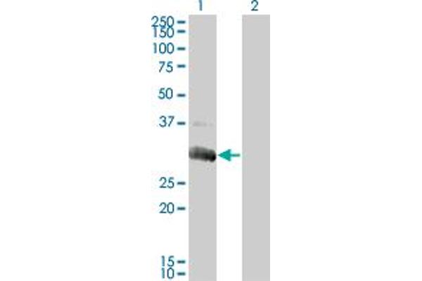 Deoxyguanosine Kinase Antikörper  (AA 1-89)