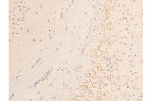 Immunohistochemistry (IHC) image for anti-Spleen tyrosine Kinase (SYK) (pTyr323) antibody (ABIN6256708)