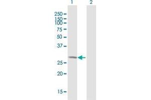 Western Blot analysis of WBSCR28 expression in transfected 293T cell line by WBSCR28 MaxPab polyclonal antibody. (WBSCR28 Antikörper  (AA 1-265))