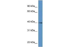 Western Blot showing PTGDR antibody used at a concentration of 1 ug/ml against Hela Cell Lysate (PTGDR Antikörper  (C-Term))