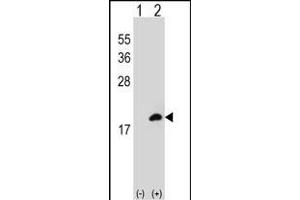 Western blot analysis of COTL1 (arrow) using rabbit polyclonal COTL1 Antibody (C-term) (ABIN652766 and ABIN2842503). (COTL1 Antikörper  (C-Term))
