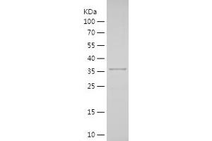 Western Blotting (WB) image for SRY (Sex Determining Region Y)-Box 17 (SOX17) (AA 218-414) protein (His tag) (ABIN7282688) (SOX17 Protein (AA 218-414) (His tag))