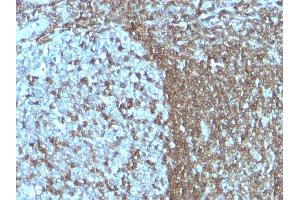 Formalin-fixed, paraffin-embedded human Tonsil stained with CD50 Monoclonal Antibody (SPM505) (ICAM-3/CD50 Antikörper)