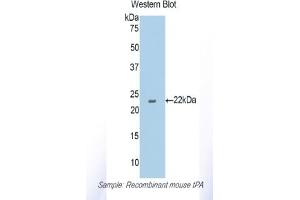 Detection of Recombinant tPA, Mouse using Polyclonal Antibody to Tissue Plasminogen Activator (tPA) (PLAT Antikörper  (AA 359-532))