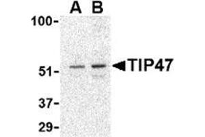 Western blot analysis of TIP47 in Daudi cell lysate with this product at (A) 0.