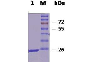 SDS-PAGE of 27 kDa native human Hsp27 protein (ABIN1686696, ABIN1686697 and ABIN1686698).
