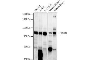 Western blot analysis of extracts of various cell lines, using PLOD1 antibody (ABIN6127272, ABIN6145784, ABIN6145786 and ABIN6223913) at 1:1000 dilution. (PLOD1 Antikörper  (AA 488-727))