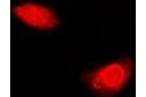 Immunofluorescent analysis of Periplakin staining in U2OS cells. (PPL Antikörper)