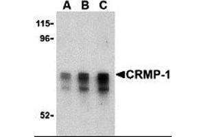 Western Blotting (WB) image for anti-Collapsin Response Mediator Protein 1 (CRMP1) (Middle Region) antibody (ABIN1030908) (CRMP1 Antikörper  (Middle Region))