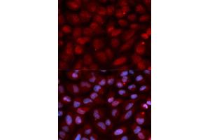 Immunofluorescence (IF) image for anti-CD47 (CD47) (AA 20-140) antibody (ABIN3022624) (CD47 Antikörper  (AA 20-140))