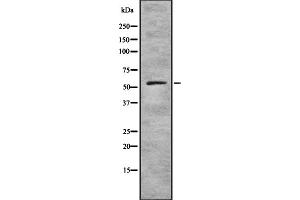 Western blot analysis of ZNF497 expression in HEK293 cells ,The lane on the left is treated with the antigen-specific peptide. (ZNF497 Antikörper)