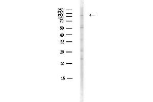 anti-Chromosome 17 Open Reading Frame 57 (C17orf57) antibody