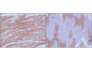 Immunohistochemical analysis of paraffin-embedded human skeletal muscle (left) and cardiac muscle (right) using MYL3 antibody with DAB staining. (MYL3/CMLC1 Antikörper)