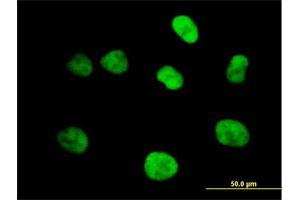 Immunofluorescence of purified MaxPab antibody to MCM4 on HeLa cell. (MCM4 Antikörper  (AA 1-863))