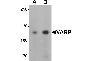 Western blot analysis of VARP in K562 cell lysate with VARP antibody at (A) 1 and (B) 2 µg/mL. (ANKRD27 Antikörper  (N-Term))