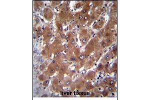 GBA3 Antibody (C-term) (ABIN656223 and ABIN2845539) immunohistochemistry analysis in formalin fixed and paraffin embedded human liver tissue followed by peroxidase conjugation of the secondary antibody and DAB staining. (GBA3 Antikörper  (C-Term))