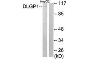 Western blot analysis of extracts from HepG2 cells, using DLGP1 Antibody. (DLGAP1 Antikörper  (AA 791-840))