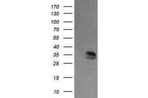 Image no. 2 for anti-Kinesin Family Member 25 (KIF25) antibody (ABIN1499040) (KIF25 Antikörper)