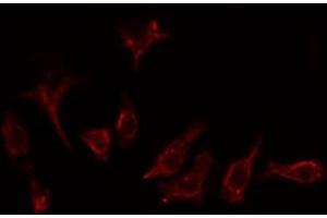 ABIN6276801 staining Hela cells by IF/ICC. (GRK2 Antikörper  (Internal Region))