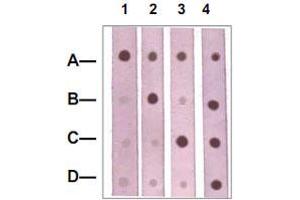 Dot Blot : 1 ug peptide was blot onto NC membrane. (CTNNB1 Antikörper  (pSer37))