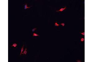 ABIN6266838 staining MCF-7 cells by IF/ICC. (DUSP16 Antikörper  (Internal Region))
