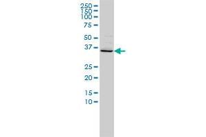 FOXR2 monoclonal antibody (M01), clone 2C1 Western Blot analysis of FOXR2 expression in Hela . (FOXR2 Antikörper  (AA 1-311))