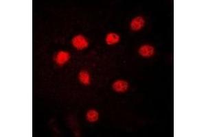 Immunofluorescent analysis of HMGB1 staining in HuvEc cells. (HMGB1 Antikörper)