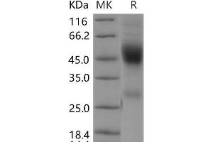 Western Blotting (WB) image for Neurexophilin 1 (NXPH1) protein (His tag) (ABIN7320126) (Neurexophilin 1 Protein (NXPH1) (His tag))